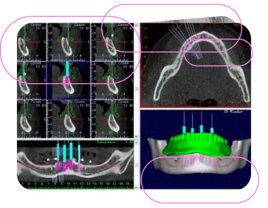 Tomografia DICOM Convertido para Dental Slice