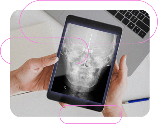 Outras indicações da Telerradiografia Frontal 