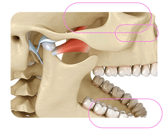 Radiografia Lateral de ATM