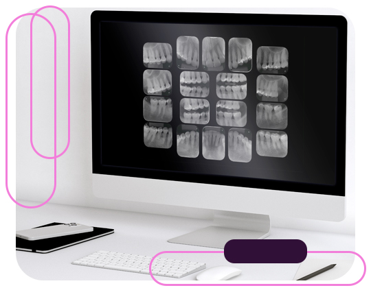 Levantamento Periapical e Radiografias Interproximais