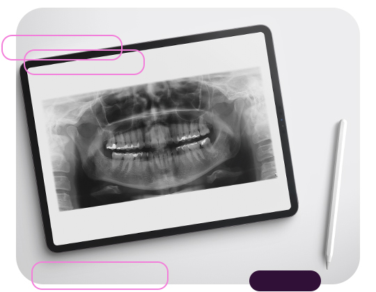 Vantagens de utilizar a radiografia panorâmica